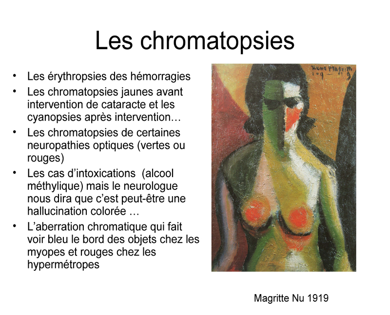 Chromatopsies
