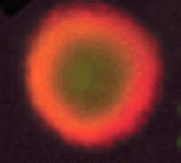 Fig 8 Immunofluorescence par double marquage