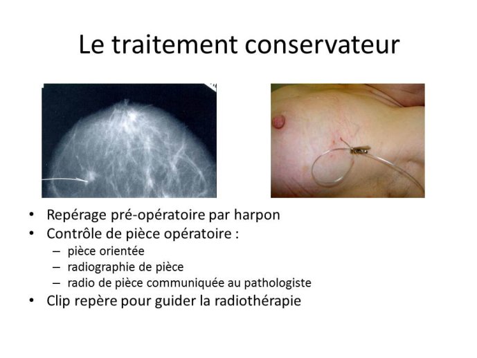 Diapositive9.JPG