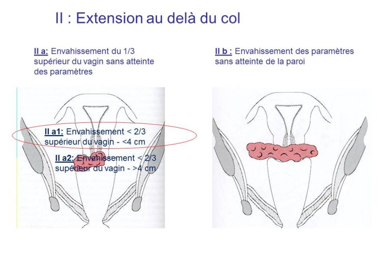 Diapositive5.JPG