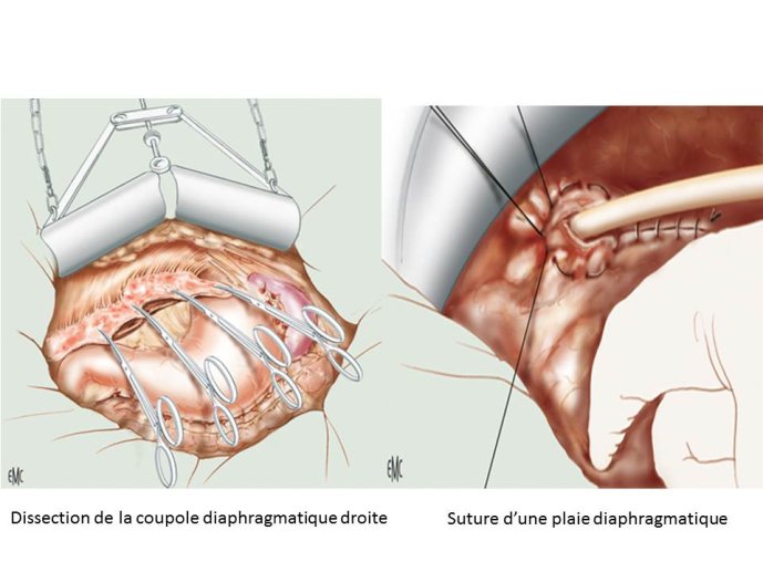 Diapositive74.JPG