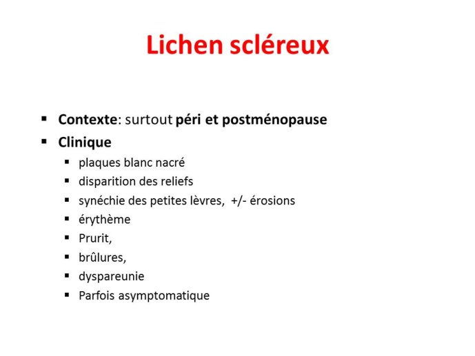 Diapositive35.JPG