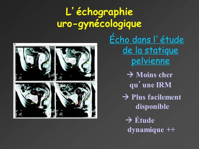 Diapositive18.JPG