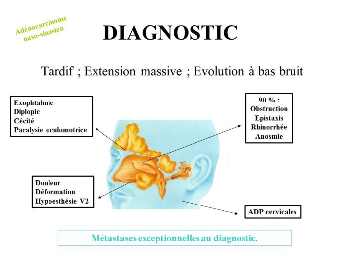 Diapositive9.JPG