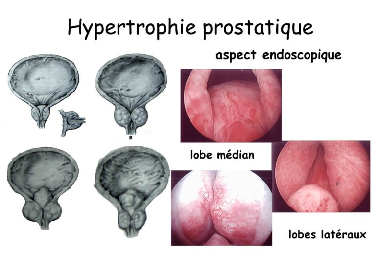 Diapositive7.JPG