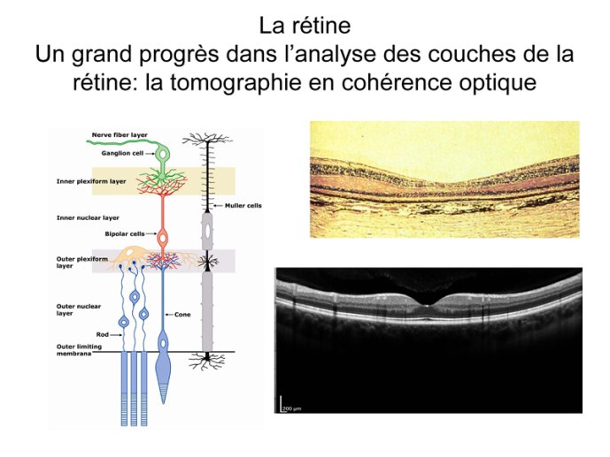 La rétine 02