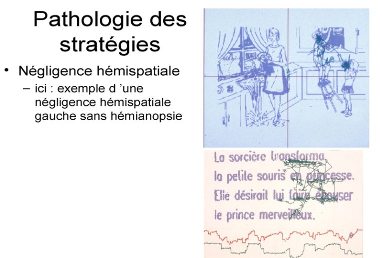 Pathologies des stratégies