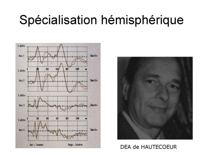 Spécialisation hémisphérique