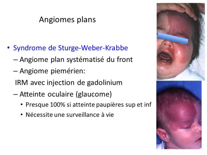 slide_0081_full.jpg