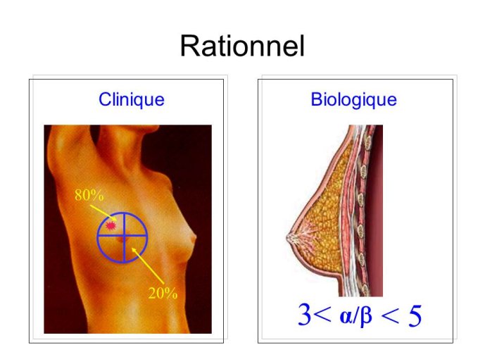 Diapositive14.JPG