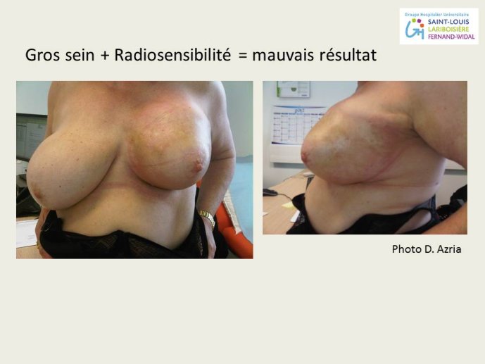 Diapositive32.JPG