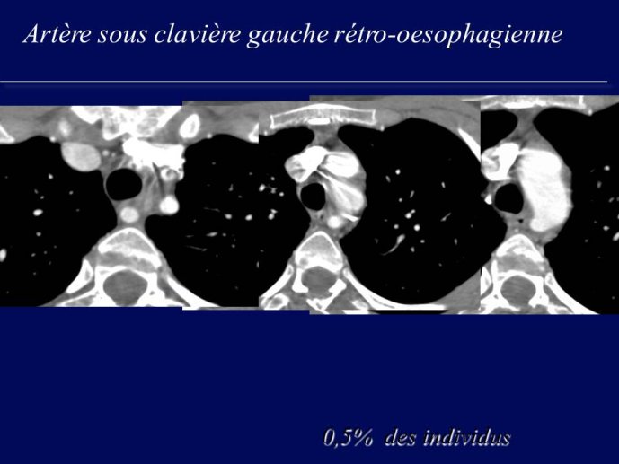 Diapositive63.JPG