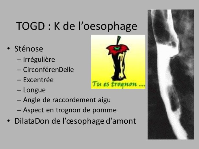 Diapositive6.JPG