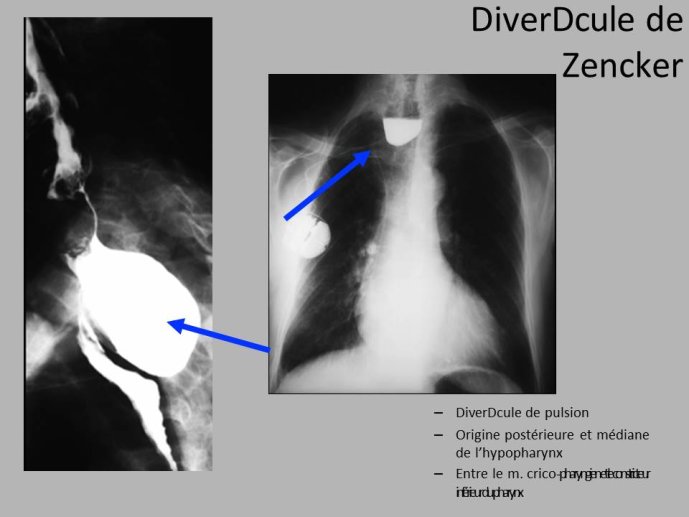 Diapositive37.JPG