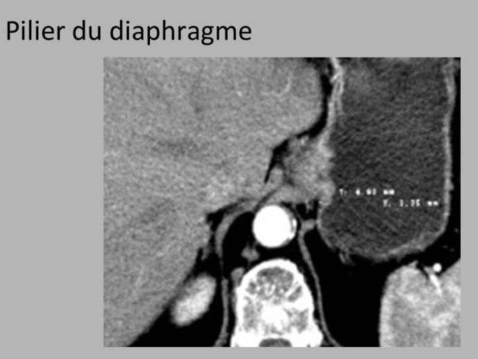 Diapositive55.JPG