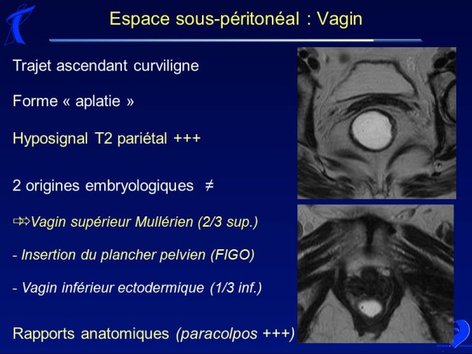 Diapositive35.JPG