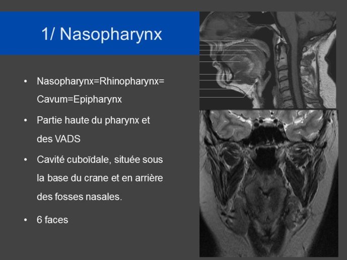 Diapositive5.JPG