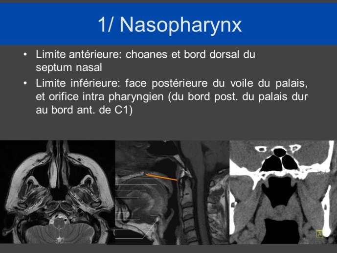 Diapositive7.JPG