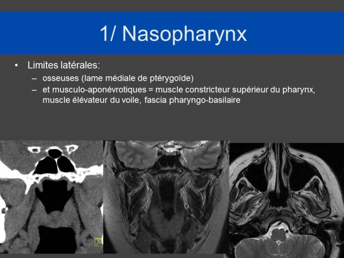 Diapositive8.JPG