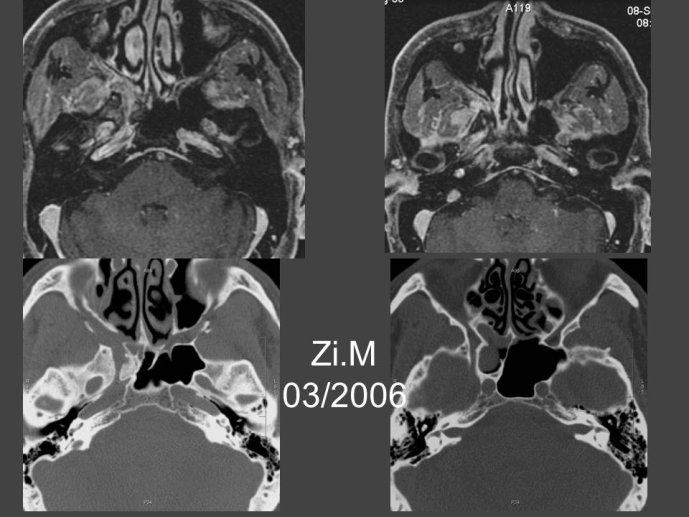 Diapositive73.JPG