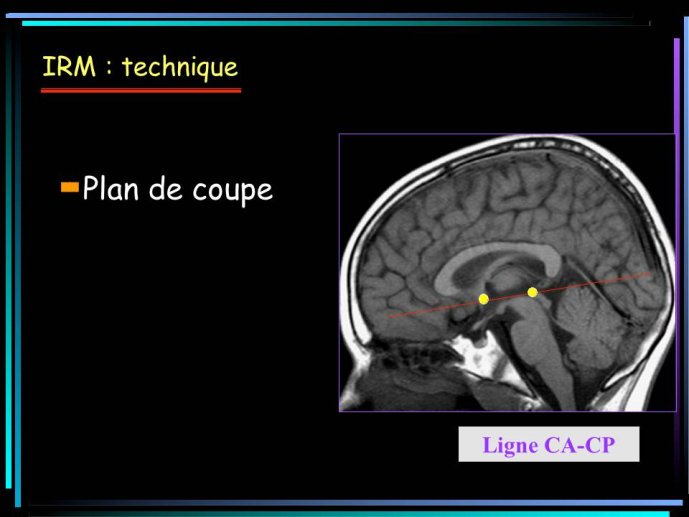 Diapositive21.JPG