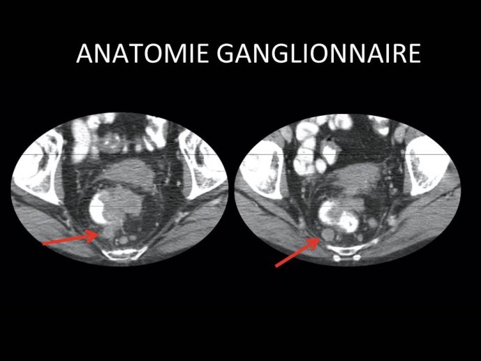 Diapositive6.JPG