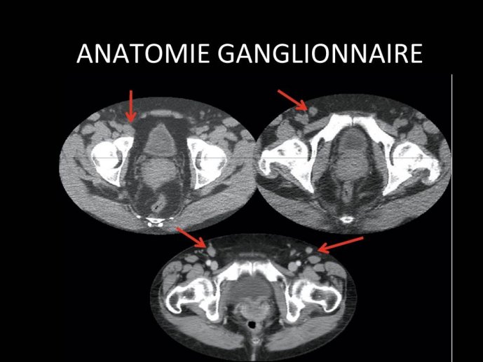 Diapositive9.JPG