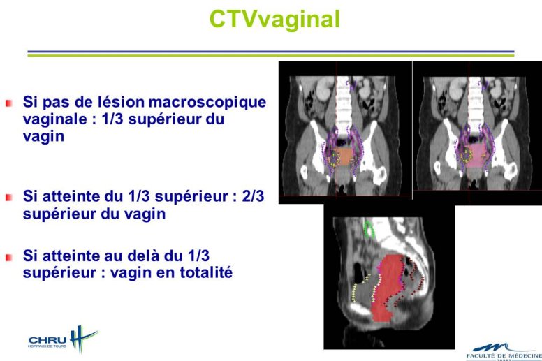 Diapositive9.JPG