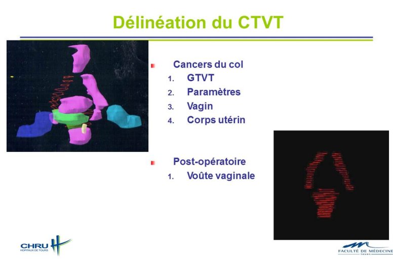 Diapositive18.JPG