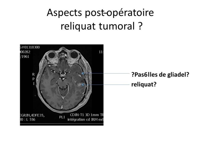 Diapositive21.JPG