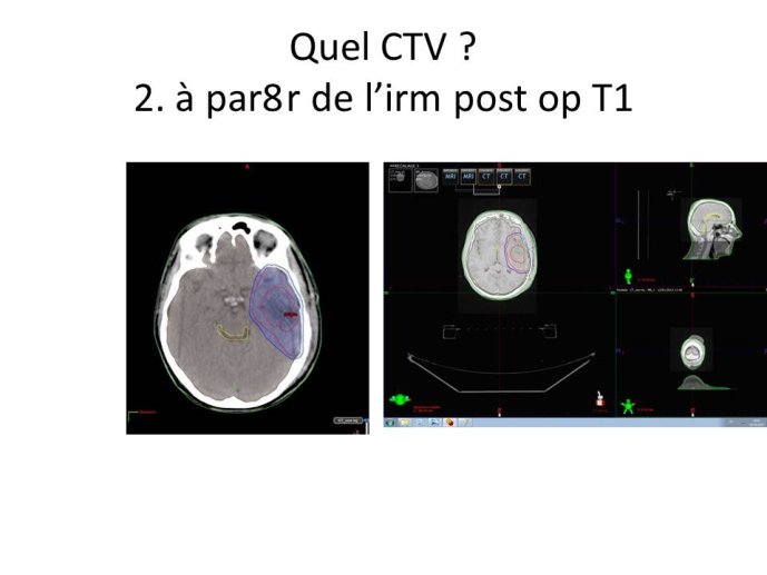 Diapositive27.JPG