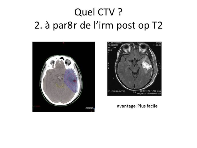 Diapositive29.JPG
