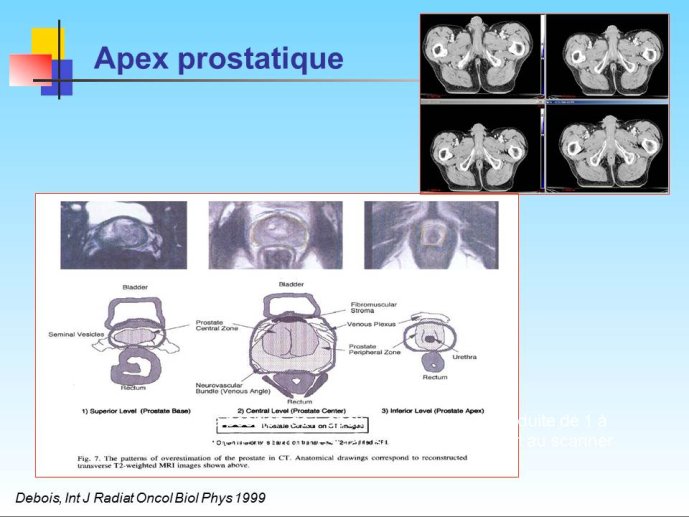 Diapositive9.JPG