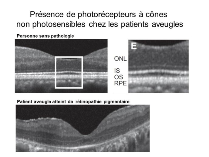 Présence de photorecepteurs à cônes