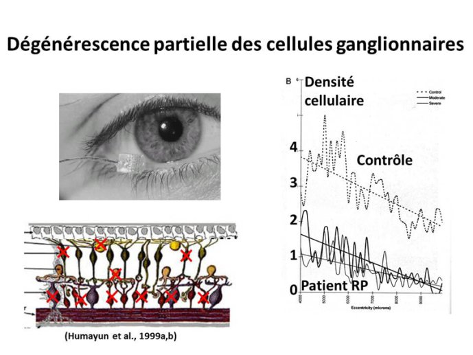 Dégénerescence partielle