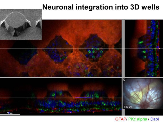 Neuronal intégration