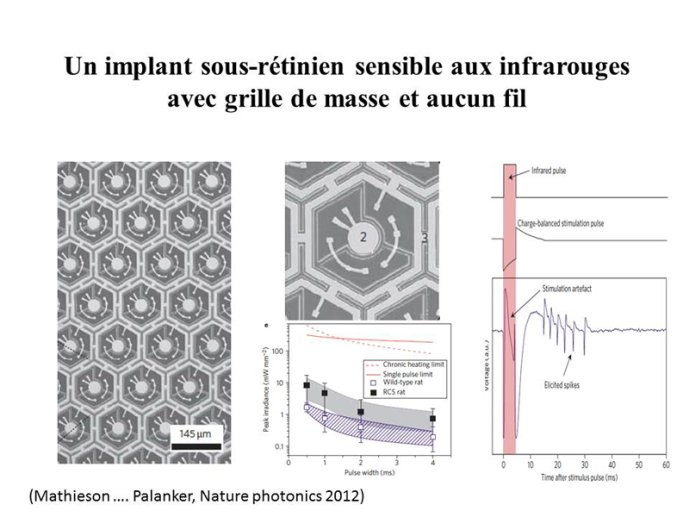 Implant aux infrarouges