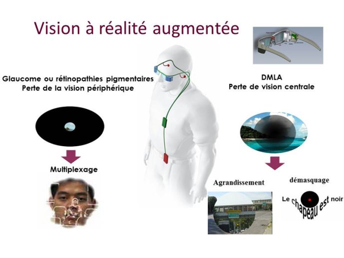 Vision à réalité augmentée