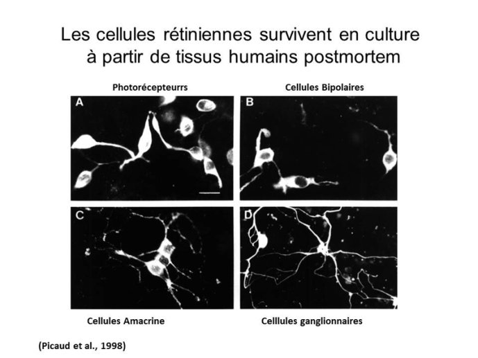 Cellules rétiniennes en culture