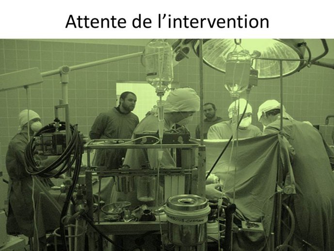 Attente de l'intervention