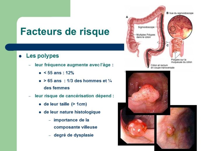Diapositive9.JPG
