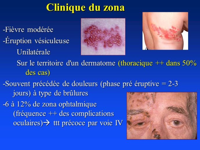 Diapositive7.JPG