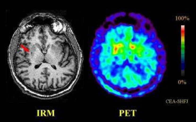 Image1: imagerie anatomique et fonctionnelle du cerveau humain.