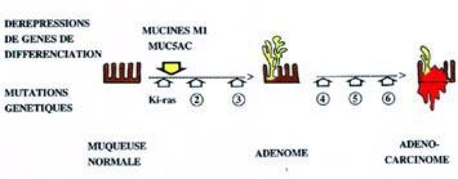 Schéma possible de cancérogenèse