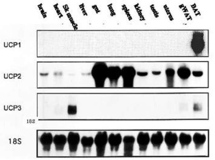 ARNs UCP1, UCP2 et UCP3