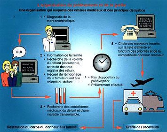 Conditions légales et techniques du don d'organe