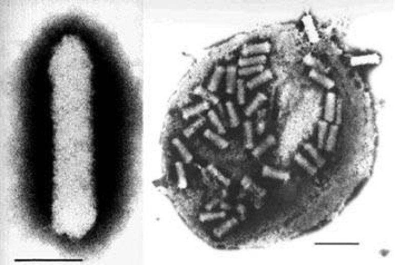 Le système baculovirus/cellules d'insecte (BVICS)