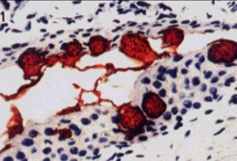 La conjonctive: les cellules à mucus