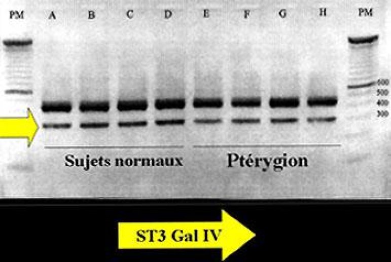 Expression de ST3GalIV.