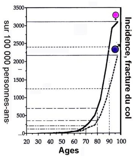 Fig 2 Incidence de la fracture du col du fémur en fonction de l'âge chez l'homme et chez la femme, en France